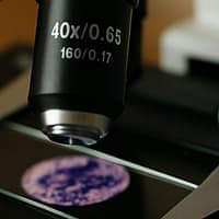 Lepră în România, după aproape jumătate de secol. Surorile din Bali au masat și participanții la Untold