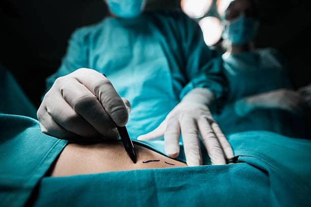Reconstrucţia sânului după mastectomie: de la vindecare la un rezultat estetic impresionant