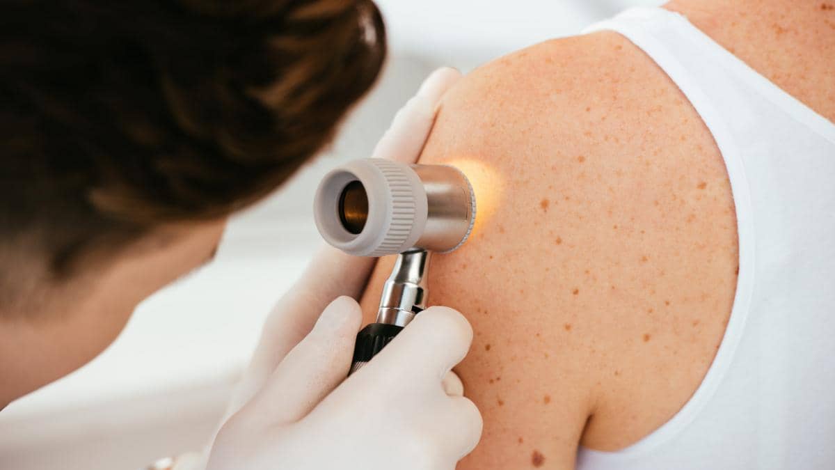 Virusul herpetic, noul tratament pentru o formă foarte gravă de cancer
