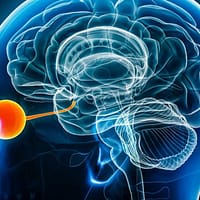 BrainGate2, noua interfață care ajută pacienții cu SLA să vorbească aproape în timp real