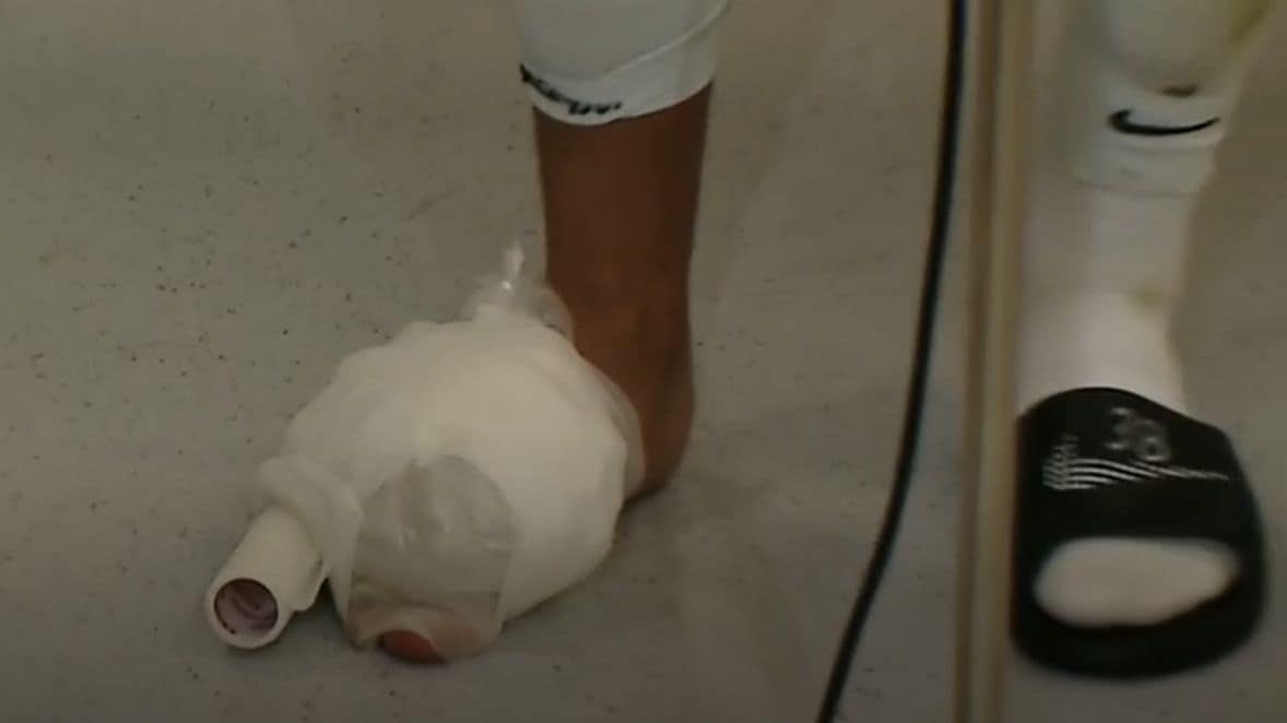 Imagini horror cu piciorul lui Mihai Lixandru. Cum a venit fotbalistul la flash-interviu