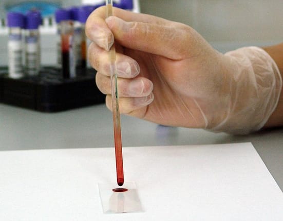 Cum poți beneficia de consultații și analize gratuite la medicul de familie. Ministerul Sănătății: Nu ai nevoie de asigurare medicală